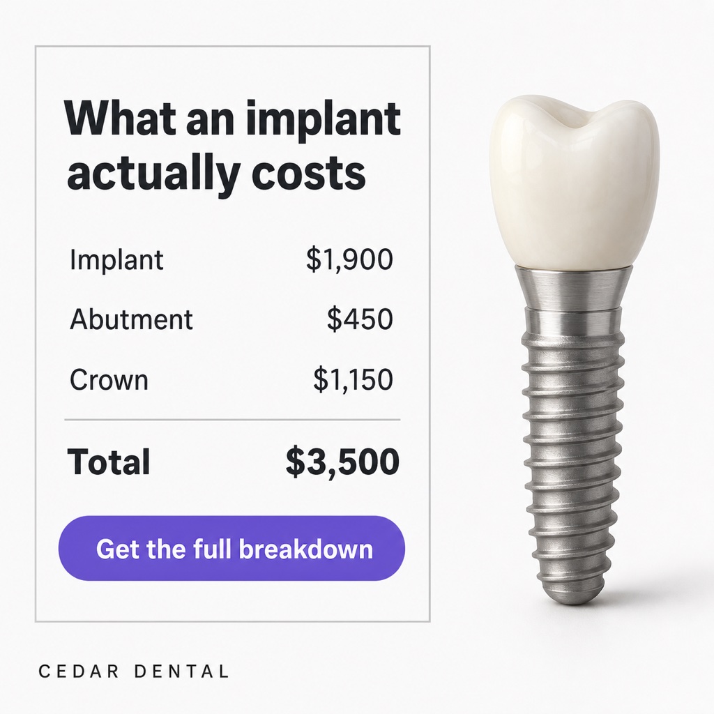 Example dental Facebook ad: itemized implant price breakdown card next to a photo of a single dental implant model